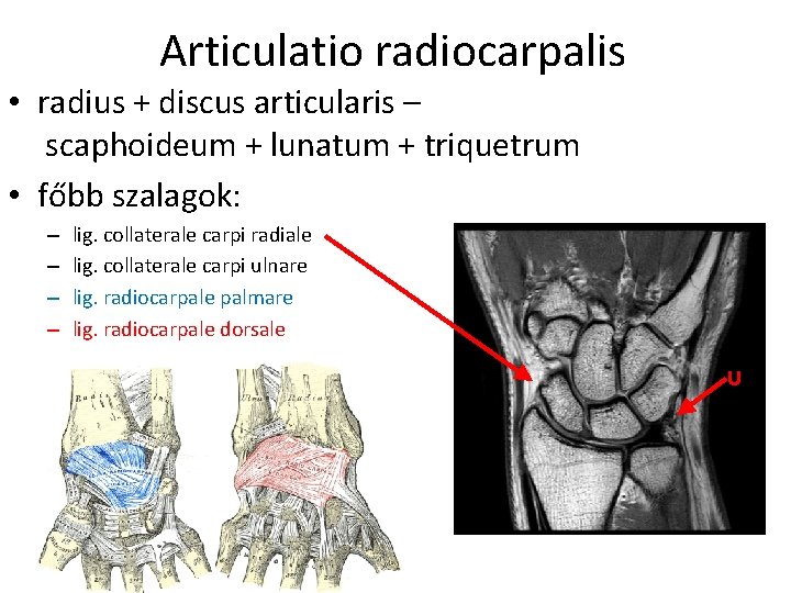 Articulatio radiocarpalis • radius + discus articularis – scaphoideum + lunatum + triquetrum •
