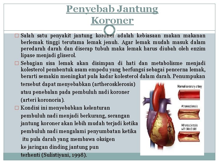 Penyebab Jantung Koroner � Salah satu penyakit jantung koroner adalah kebiasaan makanan berlemak tinggi