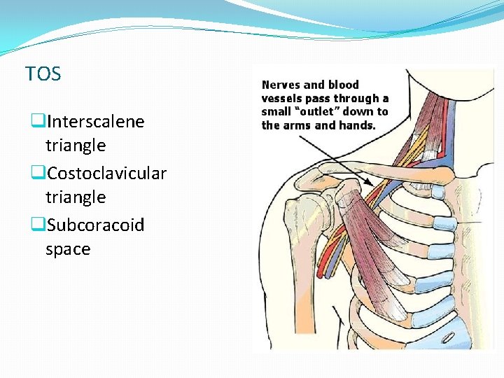 TOS q. Interscalene triangle q. Costoclavicular triangle q. Subcoracoid space TOS q. Interscalene triangle q. Costoclavicular triangle q. Subcoracoid space