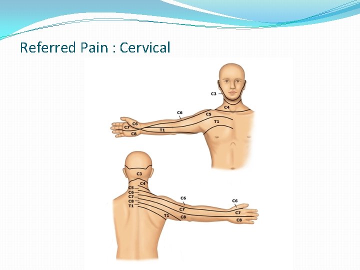 Referred Pain : Cervical Referred Pain : Cervical