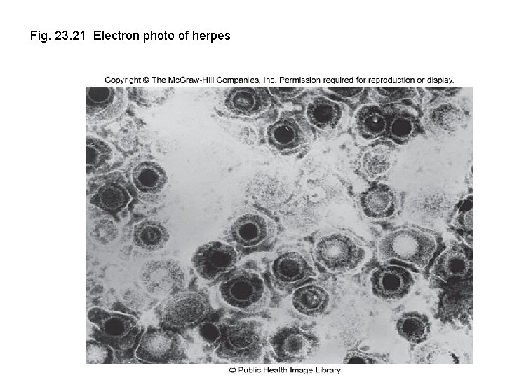 Fig. 23. 21 Electron photo of herpes 