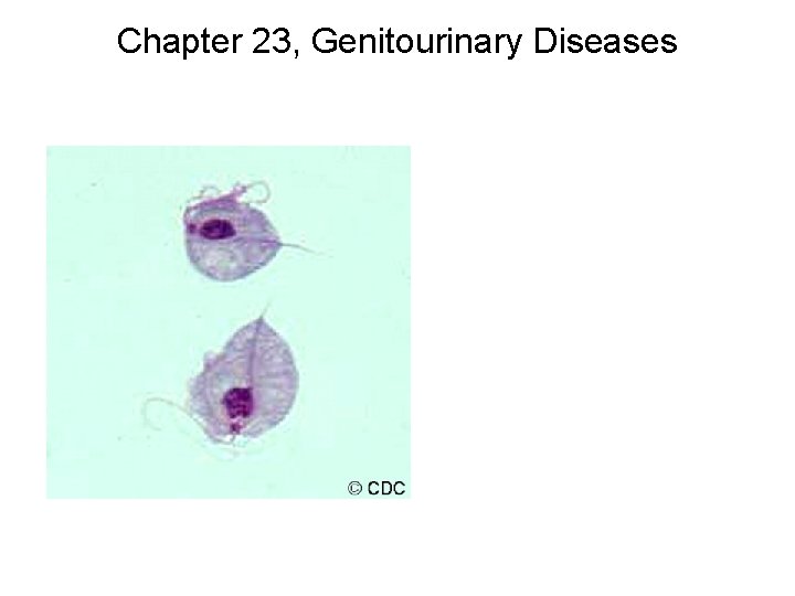 Chapter 23, Genitourinary Diseases 