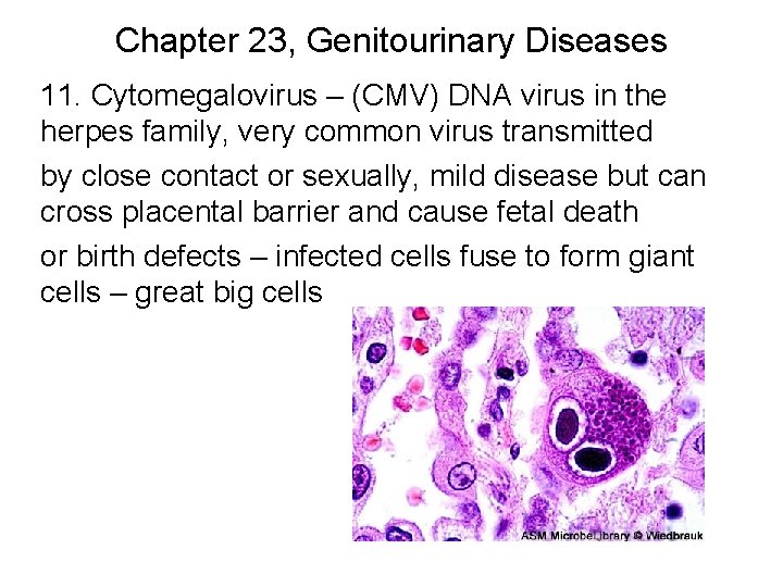 Chapter 23, Genitourinary Diseases 11. Cytomegalovirus – (CMV) DNA virus in the herpes family,