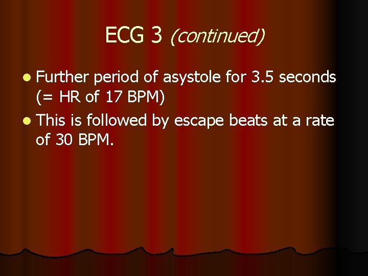 ECG 3 (continued) l Further period of asystole for 3. 5 seconds (= HR