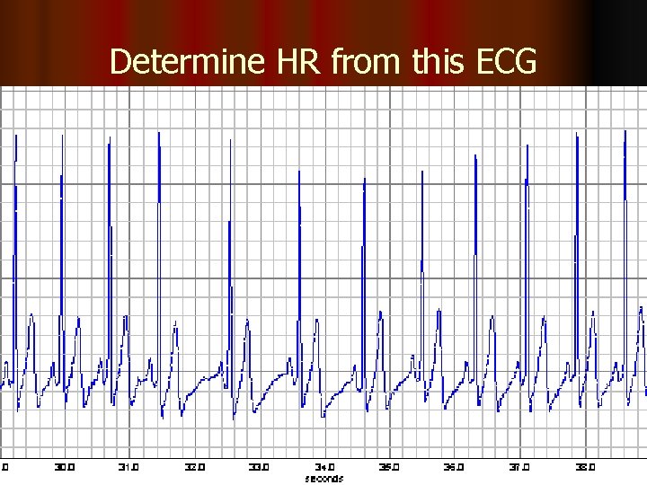 Determine HR from this ECG 