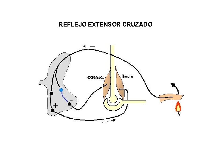 REFLEJO EXTENSOR CRUZADO 