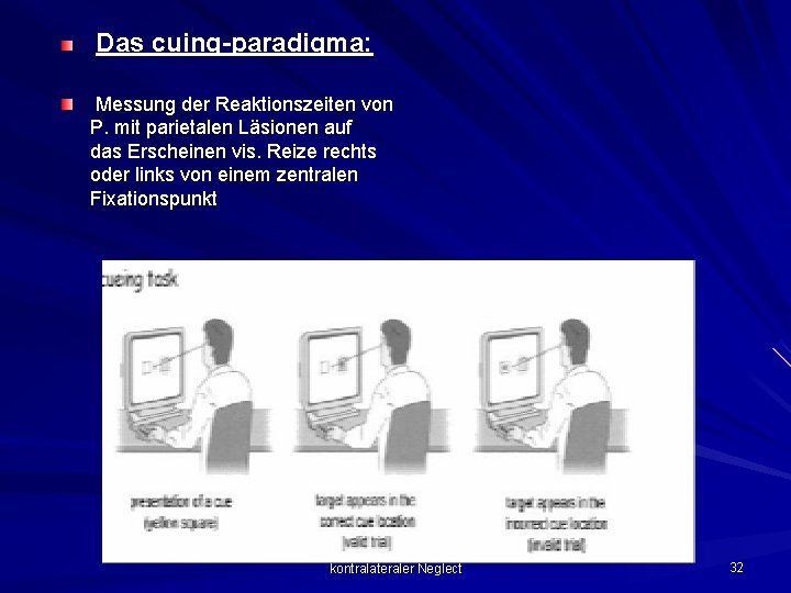 Das cuing-paradigma: Messung der Reaktionszeiten von P. mit parietalen Läsionen auf das Erscheinen vis.