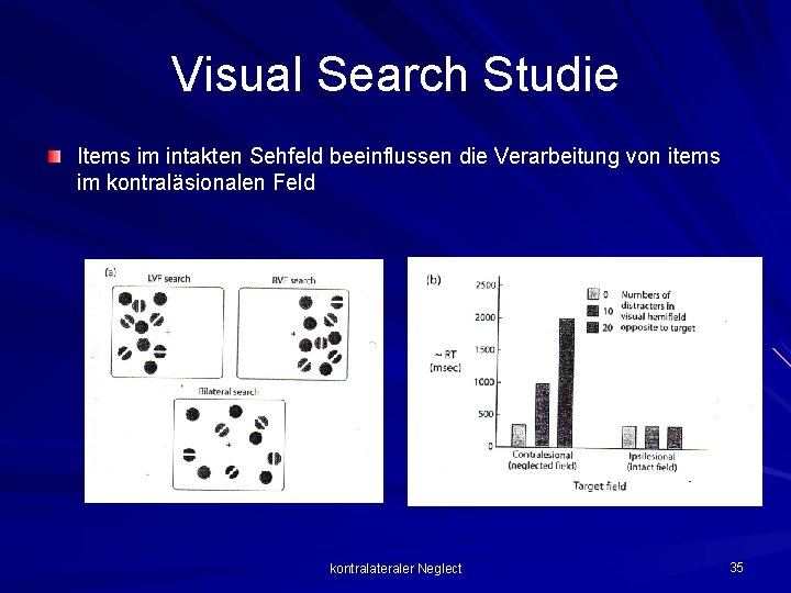 Visual Search Studie Items im intakten Sehfeld beeinflussen die Verarbeitung von items im kontraläsionalen