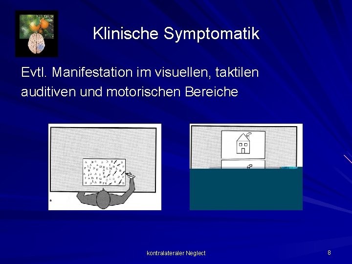 Klinische Symptomatik Evtl. Manifestation im visuellen, taktilen auditiven und motorischen Bereiche kontralateraler Neglect 8