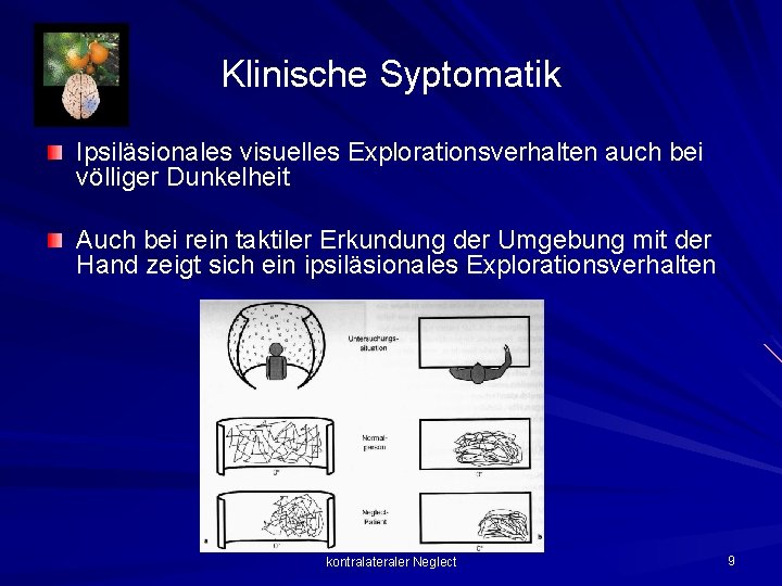 Klinische Syptomatik Ipsiläsionales visuelles Explorationsverhalten auch bei völliger Dunkelheit Auch bei rein taktiler Erkundung