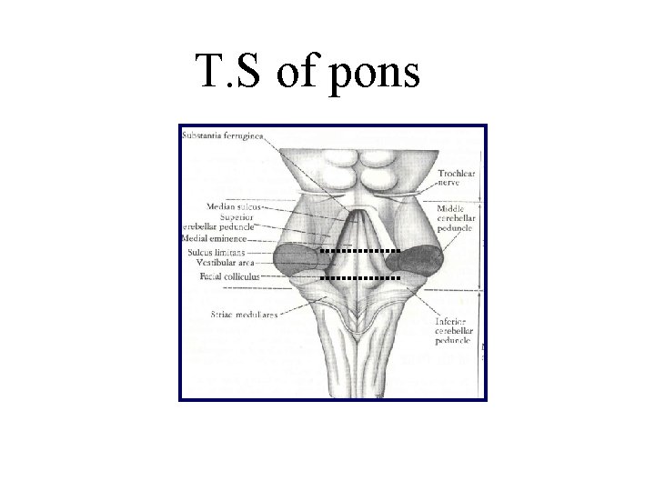 T. S of pons T. S of pons