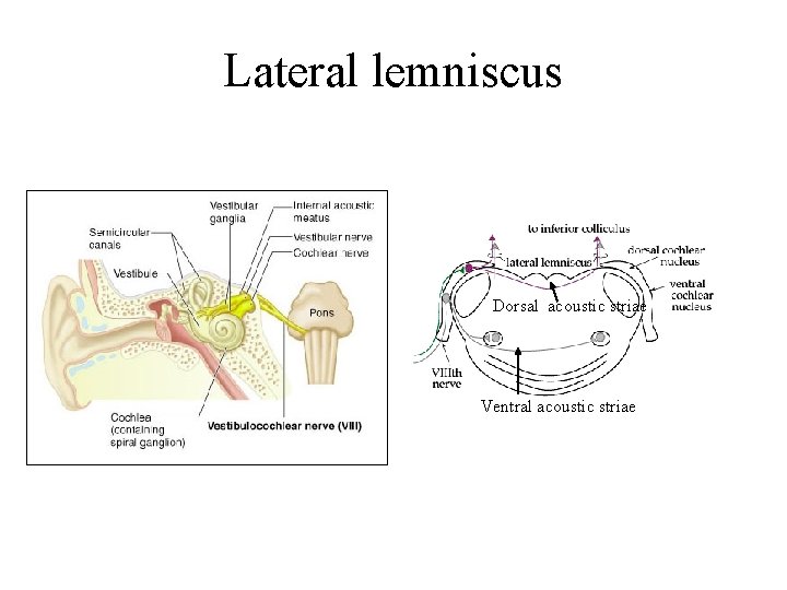 Lateral lemniscus Dorsal acoustic striae Ventral acoustic striae Lateral lemniscus Dorsal acoustic striae Ventral acoustic striae