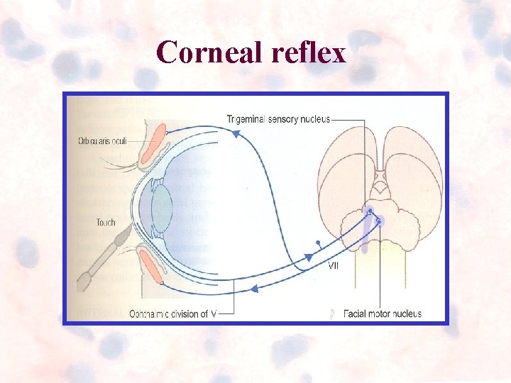 Corneal reflex Corneal reflex