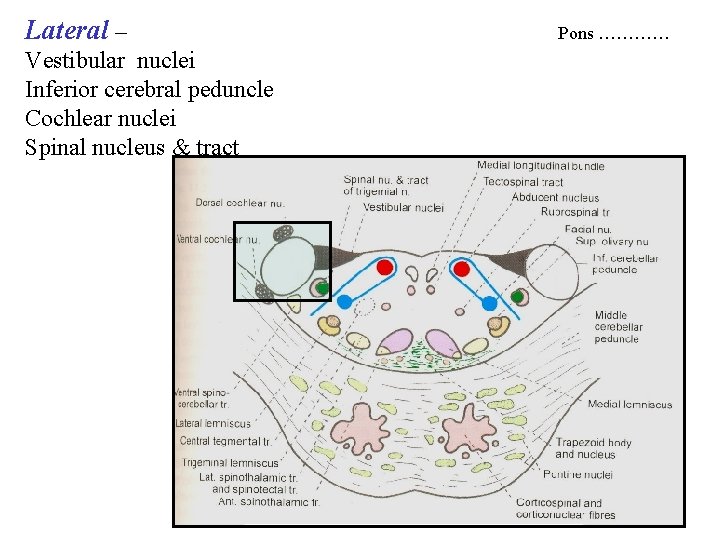 Lateral – Vestibular nuclei Inferior cerebral peduncle Cochlear nuclei Spinal nucleus & tract Pons Lateral – Vestibular nuclei Inferior cerebral peduncle Cochlear nuclei Spinal nucleus & tract Pons