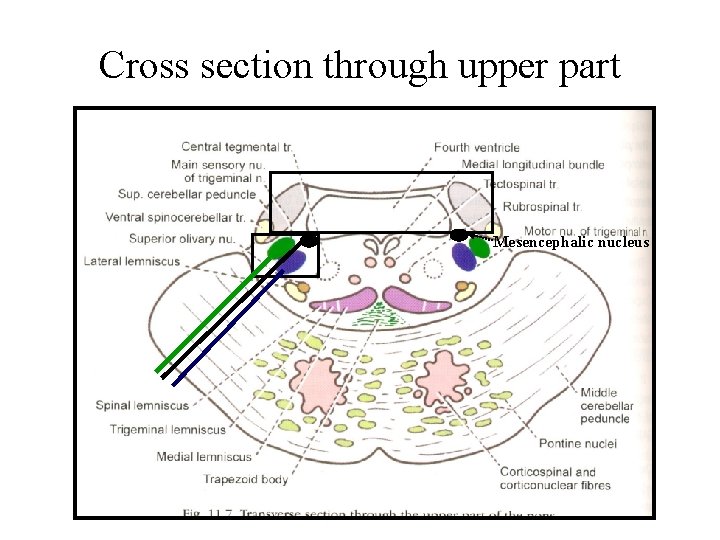 Cross section through upper part Mesencephalic nucleus Cross section through upper part Mesencephalic nucleus