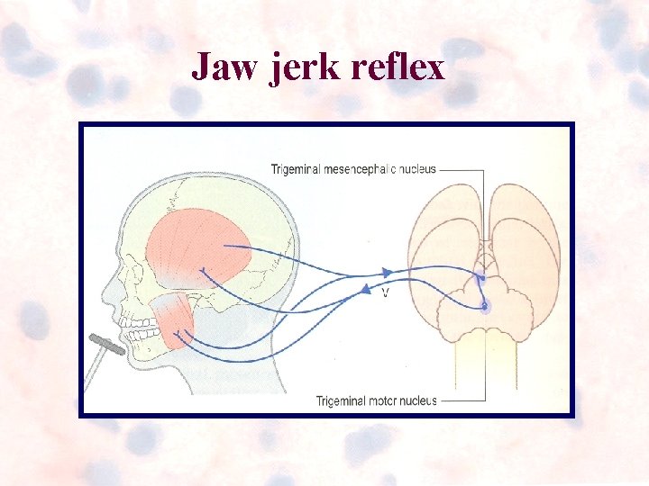 Jaw jerk reflex Jaw jerk reflex