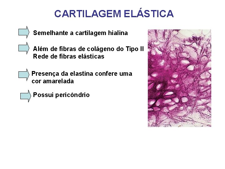 CARTILAGEM ELÁSTICA Semelhante a cartilagem hialina Além de fibras de colágeno do Tipo II CARTILAGEM ELÁSTICA Semelhante a cartilagem hialina Além de fibras de colágeno do Tipo II