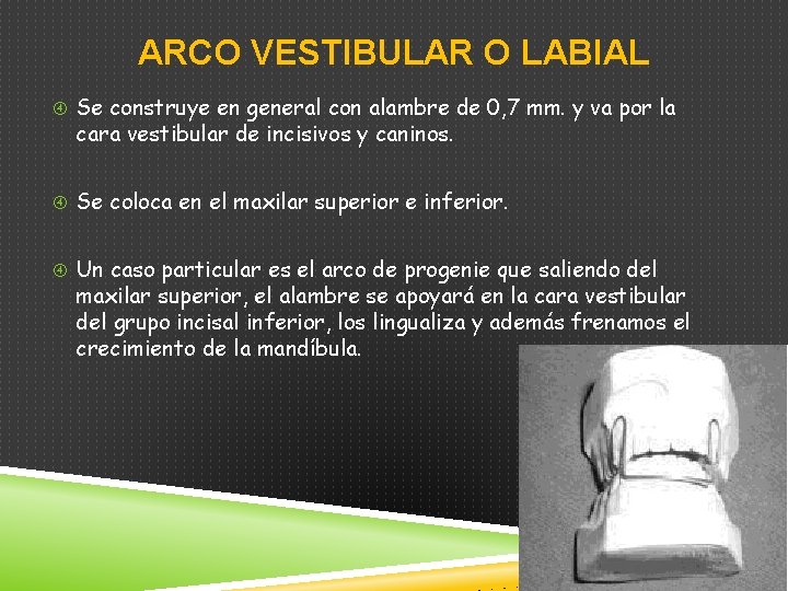ARCO VESTIBULAR O LABIAL Se construye en general con alambre de 0, 7 mm.