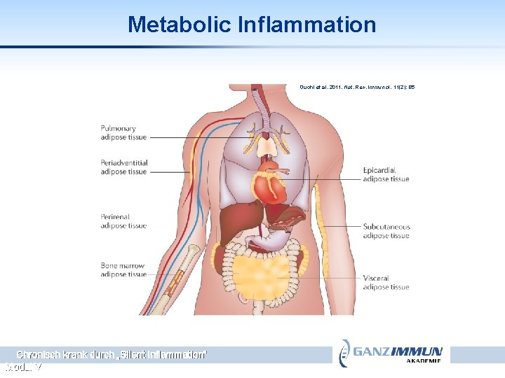 Metabolic Inflammation Ouchi et al. 2011. Nat. Rev. Immunol. 11(2): 85 Chronisch krank durch