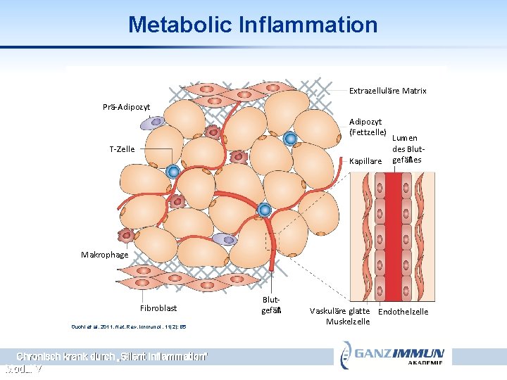 Metabolic Inflammation Extrazelluläre Matrix Prä-Adipozyt (Fettzelle) T-Zelle Kapillare Lumen des Blutgefäßes Makrophage Fibroblast Ouchi