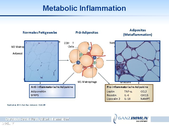 Metabolic Inflammation Normales Fettgewebe CD 4+ T-Zelle (Th 2) M 2 Makrophage Prä-Adipositas (Metaflammation)