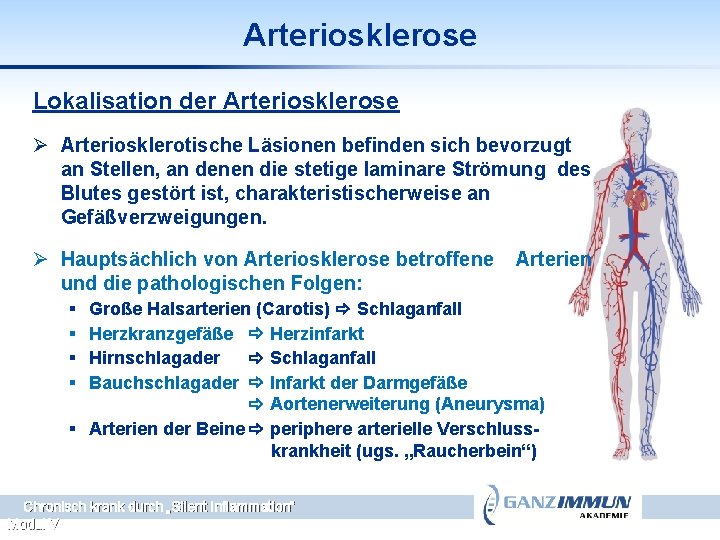 Arteriosklerose Lokalisation der Arteriosklerose Ø Arteriosklerotische Läsionen befinden sich bevorzugt an Stellen, an denen