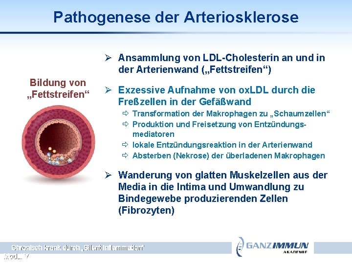 Pathogenese der Arteriosklerose Ø Ansammlung von LDL-Cholesterin an und in der Arterienwand („Fettstreifen“) Bildung
