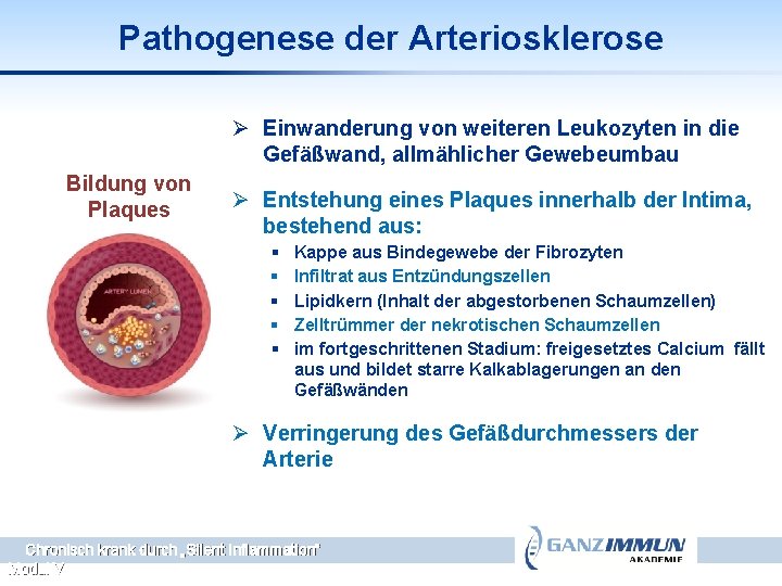 Pathogenese der Arteriosklerose Ø Einwanderung von weiteren Leukozyten in die Gefäßwand, allmählicher Gewebeumbau Bildung
