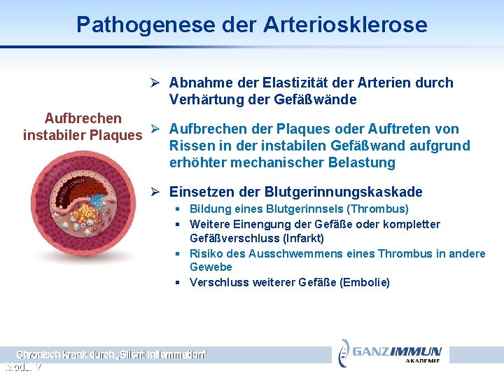 Pathogenese der Arteriosklerose Ø Abnahme der Elastizität der Arterien durch Verhärtung der Gefäßwände Aufbrechen