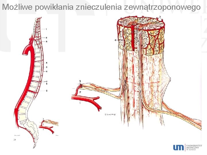 Możliwe powikłania znieczulenia zewnątrzoponowego 