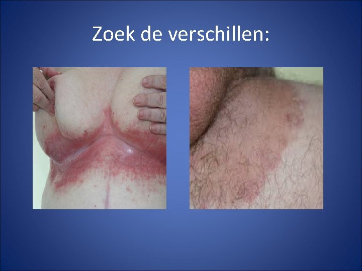 Zoek de verschillen: Zoek de verschillen: