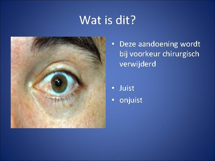 Wat is dit? • Deze aandoening wordt bij voorkeur chirurgisch verwijderd • Juist • Wat is dit? • Deze aandoening wordt bij voorkeur chirurgisch verwijderd • Juist •