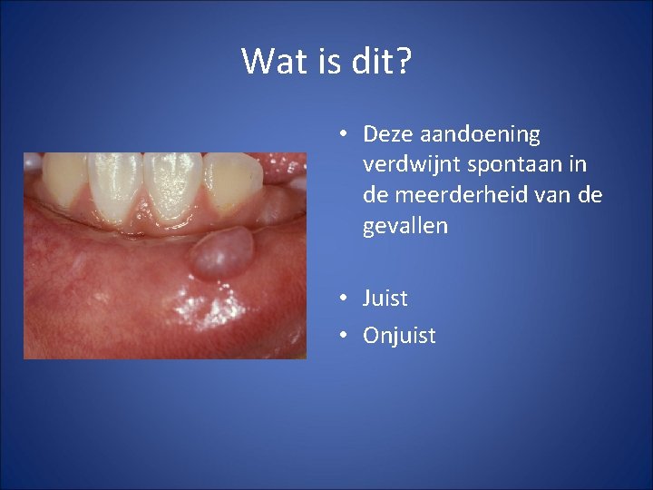 Wat is dit? • Deze aandoening verdwijnt spontaan in de meerderheid van de gevallen