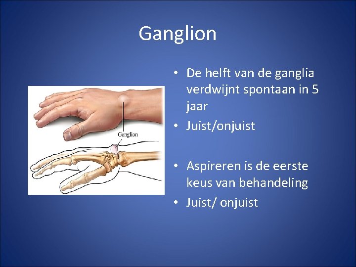 Ganglion • De helft van de ganglia verdwijnt spontaan in 5 jaar • Juist/onjuist