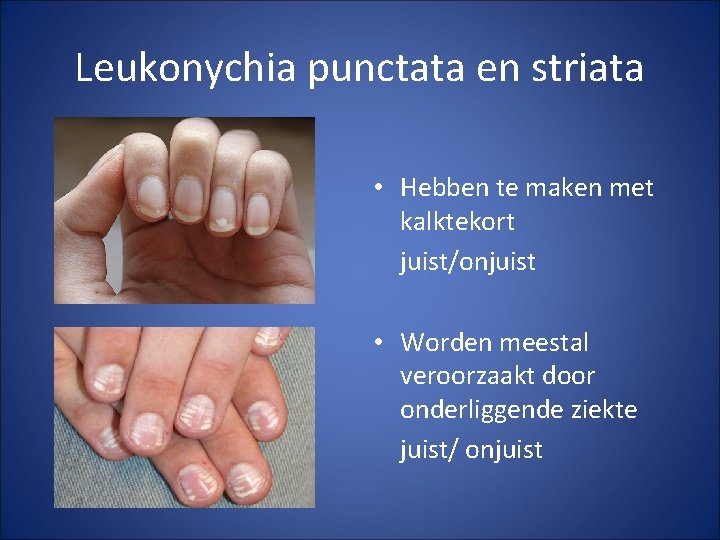 Leukonychia punctata en striata • Hebben te maken met kalktekort juist/onjuist • Worden meestal