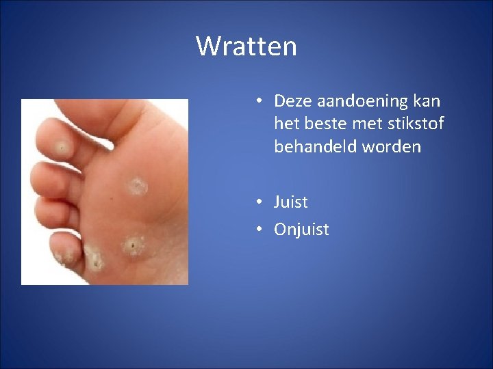 Wratten • Deze aandoening kan het beste met stikstof behandeld worden • Juist • Wratten • Deze aandoening kan het beste met stikstof behandeld worden • Juist •