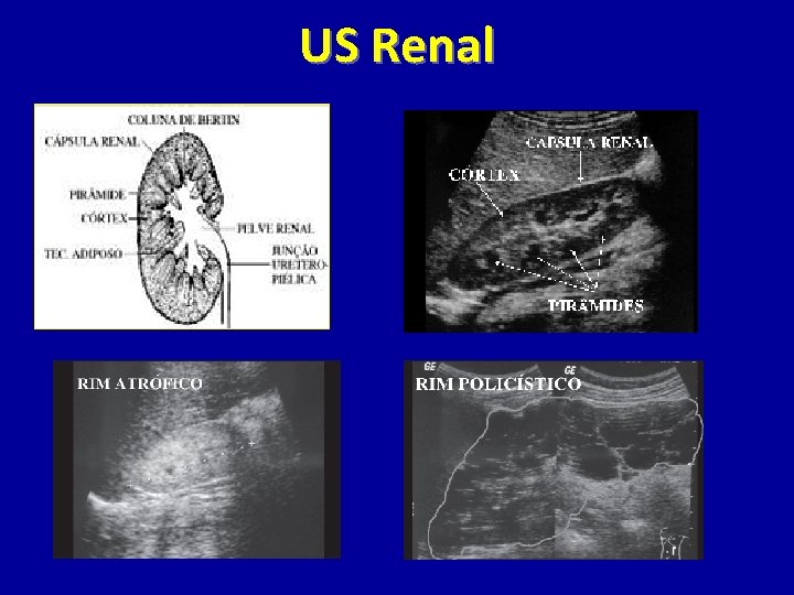 US Renal 