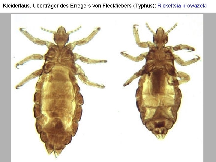 Kleiderlaus, Überträger des Erregers von Fleckfiebers (Typhus): Rickettsia prowazeki 