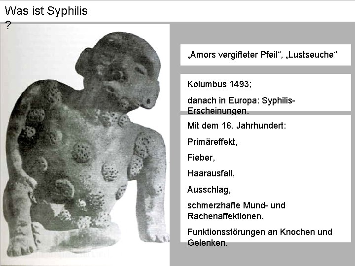 Was ist Syphilis ? „Amors vergifteter Pfeil“, „Lustseuche“ Kolumbus 1493; danach in Europa: Syphilis.