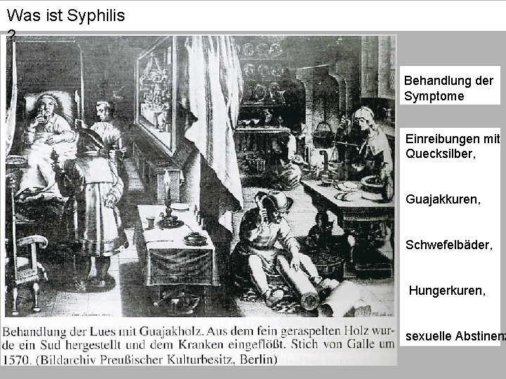 Was ist Syphilis ? Behandlung der Symptome Einreibungen mit Quecksilber, Guajakkuren, Schwefelbäder, Hungerkuren, sexuelle