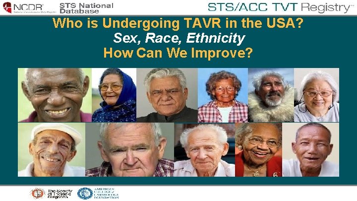 Who is Undergoing TAVR in the USA? Sex, Race, Ethnicity How Can We Improve?