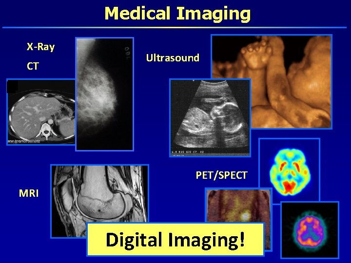 Medical Imaging X-Ray CT Ultrasound PET/SPECT MRI Digital Imaging! 