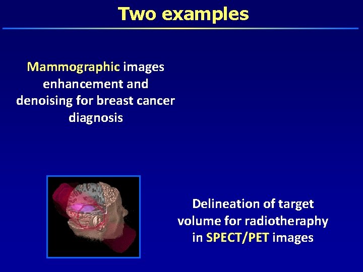 Two examples Mammographic images enhancement and denoising for breast cancer diagnosis Delineation of target