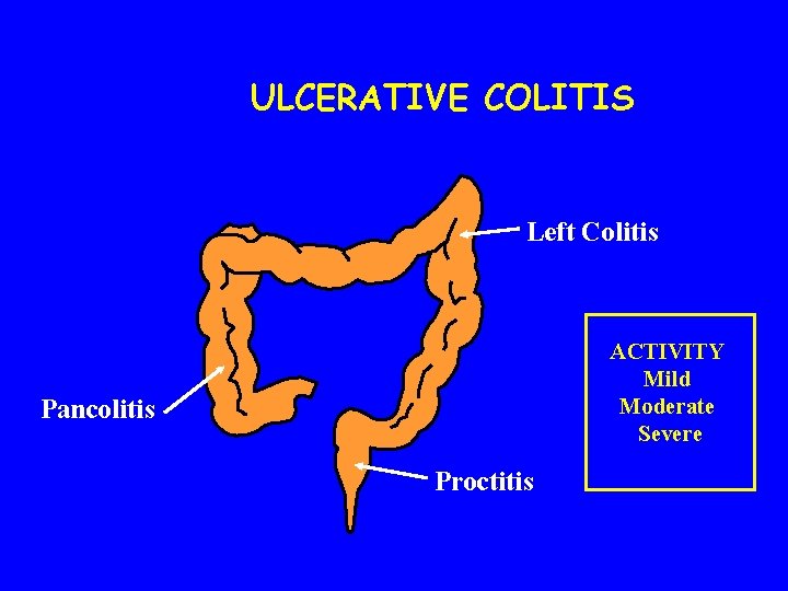 ULCERATIVE COLITIS Left Colitis ACTIVITY Mild Moderate Severe Pancolitis Proctitis 