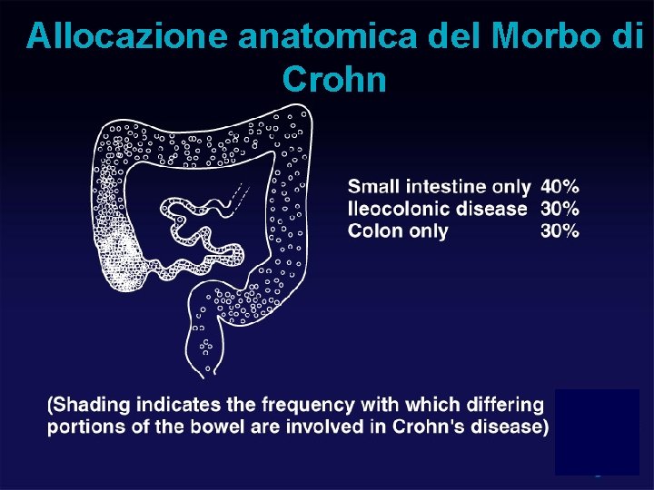 Allocazione anatomica del Morbo di Crohn 