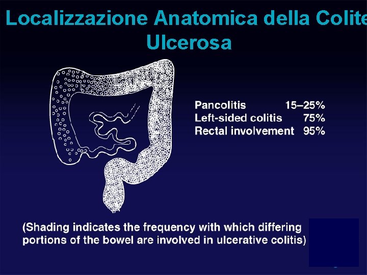 Localizzazione Anatomica della Colite Ulcerosa 