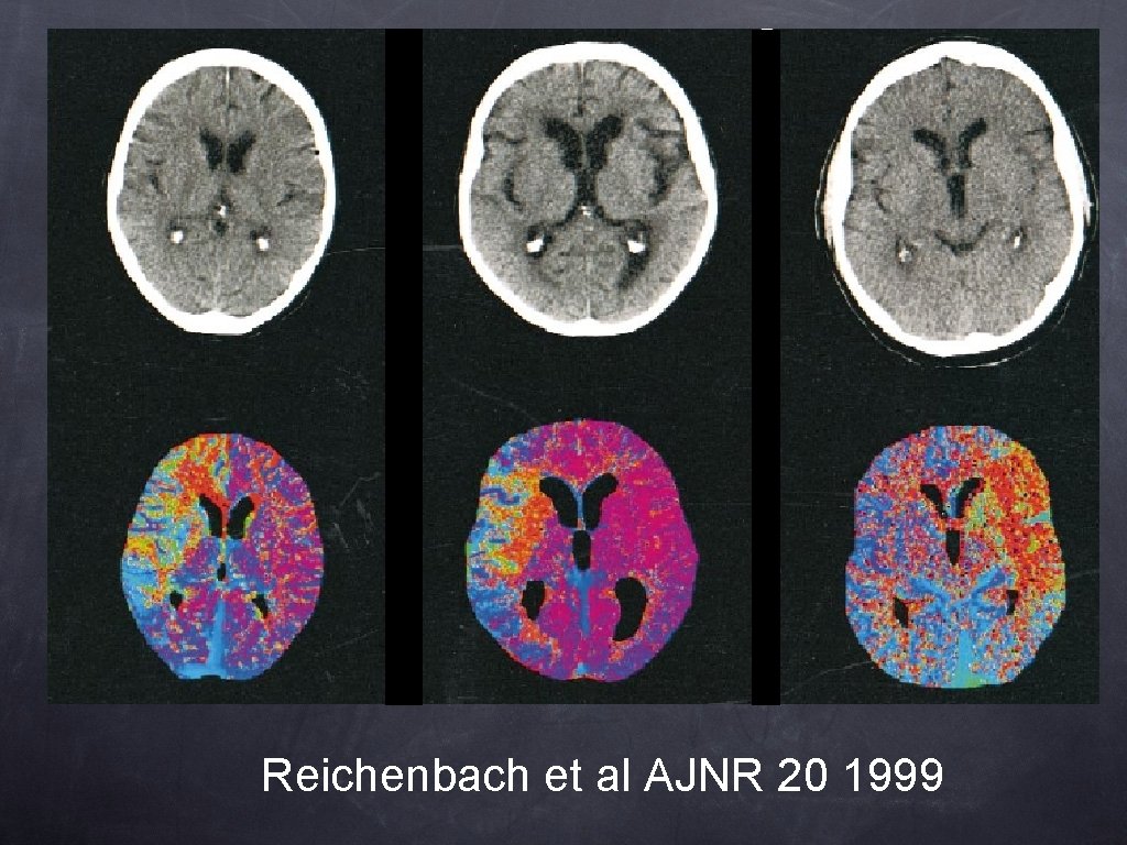 Reichenbach et al AJNR 20 1999 Reichenbach et al AJNR 20 1999