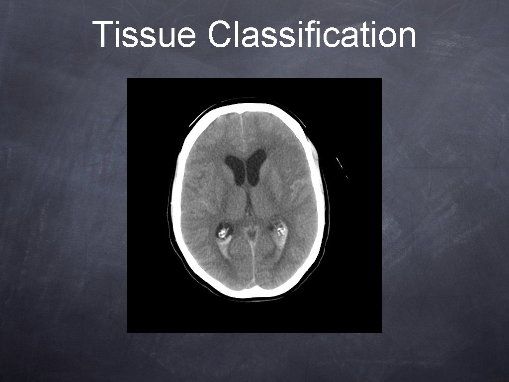 Tissue Classification Tissue Classification