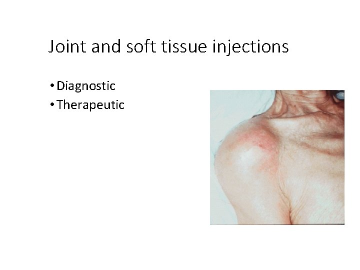 Joint and soft tissue injections • Diagnostic • Therapeutic 