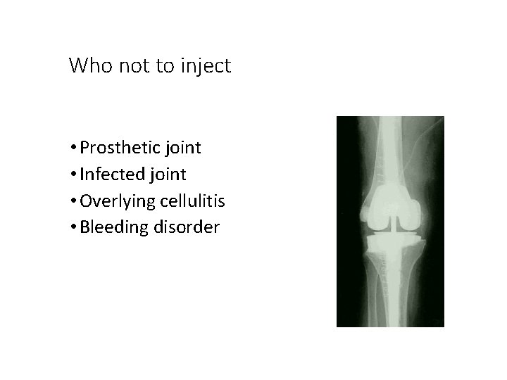 Who not to inject • Prosthetic joint • Infected joint • Overlying cellulitis •